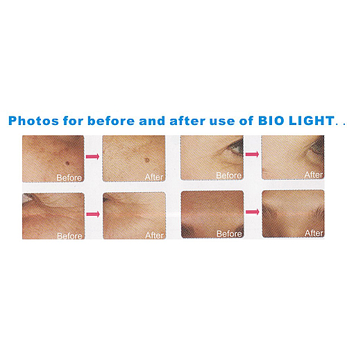 4 Color LED BIO Light Beauty Equipment